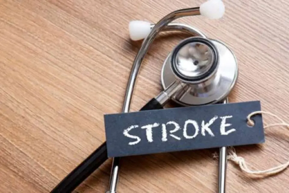 Ilmuwan Kembangkan Replika Pembuluh Darah untuk Prediksi Risiko Stroke yang Lebih Akurat